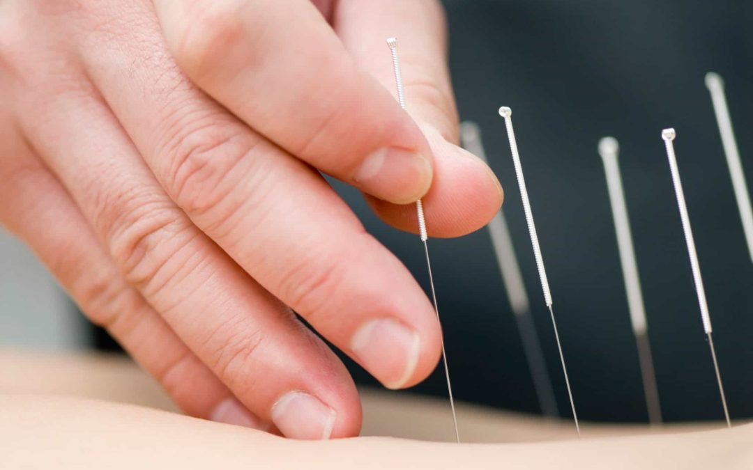 How Dr. Huang Achieved a Miracle: Curing 25 Years of Nausea in Just One Acupuncture Session with Traditional Chinese Herbal Medicine